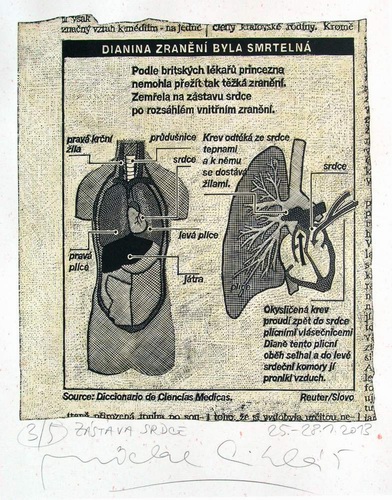 Michal Cihlář: Zástava srdce / 2011